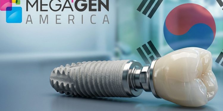 ایمپلنت مگاژن (MegaGen) | قیمت 1405، مزایا، معایب و مقایسه کامل