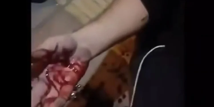 ببینید/ لحظه دستگیری عامل کتک زدن دختران جوان با دست زخمی