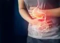 حمله قلبی یا رفلاکس معده؟ چگونه تفاوت این 2 را تشخیص دهیم؟