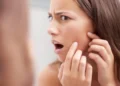 پوستت بعد از یک محصول جدید پر از جوش شده؟ این ۶ نشانه را بررسی کن