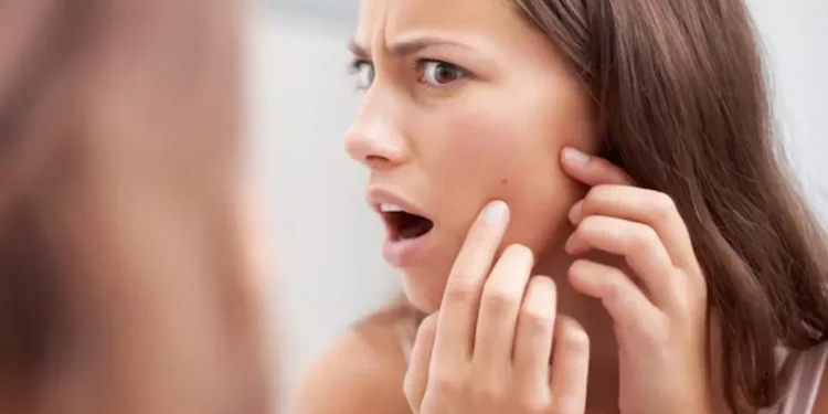 پوستت بعد از یک محصول جدید پر از جوش شده؟ این ۶ نشانه را بررسی کن